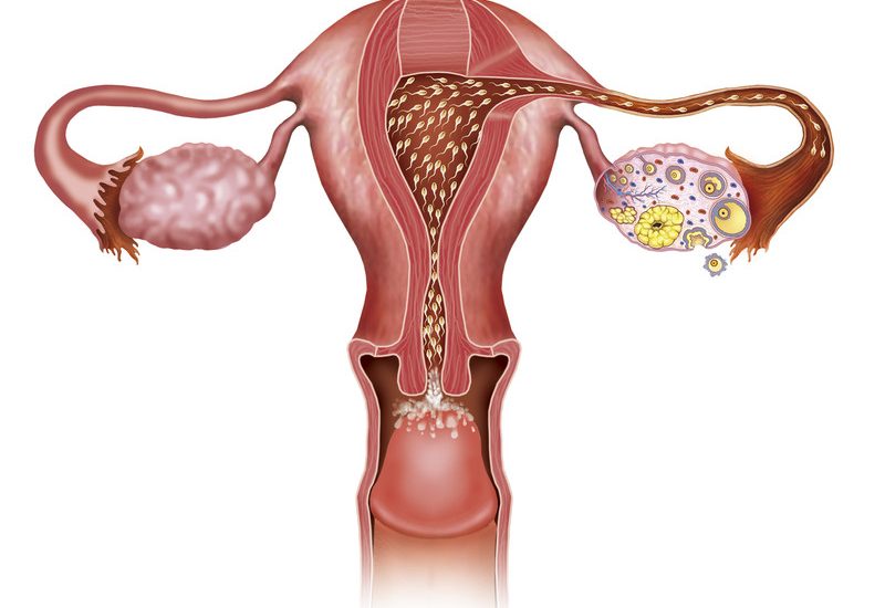 Schematische tekening die toont hoe mannelijke zaadcellen opweg zijn naar de eicel van een vrouw.